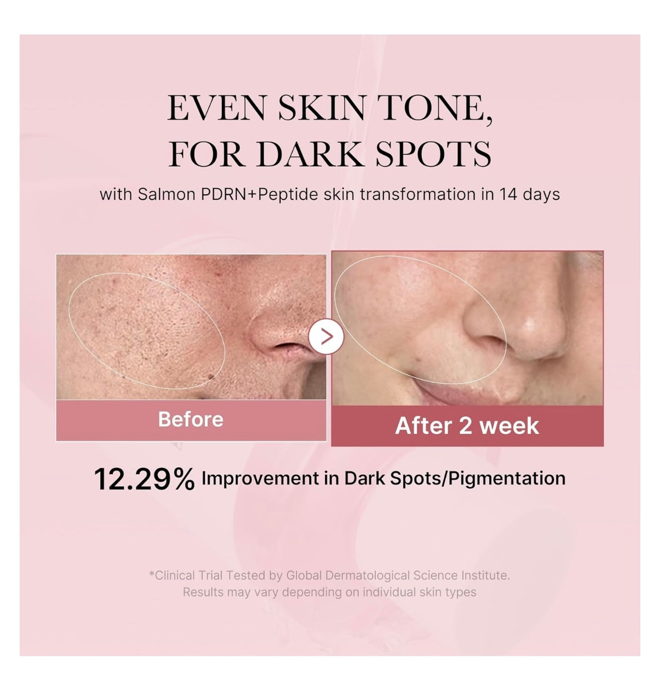 PDRN Pink Cica Soothing Toner